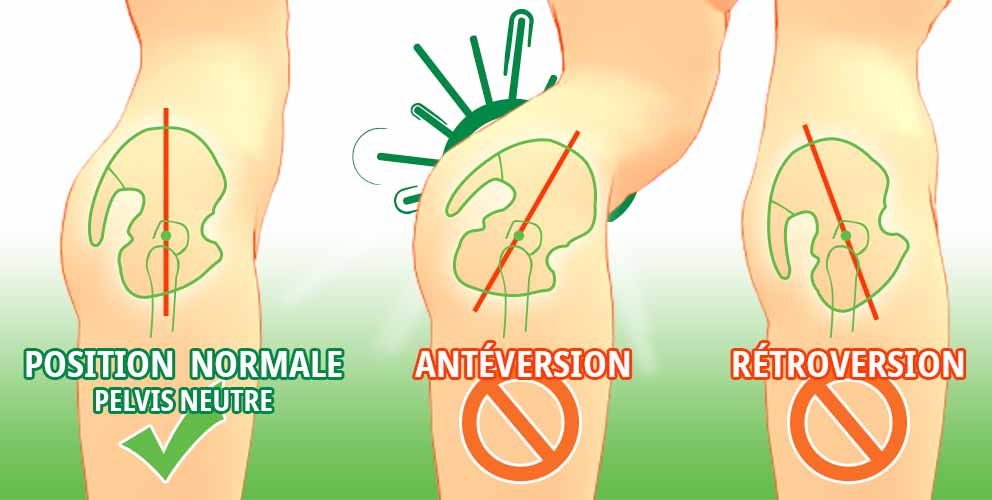 Antéversion e t rétroversion du bassin - Tous droits réservés